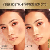 Lakme Absolute Perfect Radiance Skin Brightening Face Serum With Niacinamide, Witch Hazel, Vita-Resorcinol For Radiant & Glowing Skin, 30 ml - Beauty from LAKMÉ - Shop in Sri Lanka at Arcade.lk